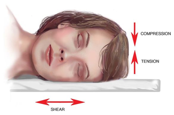 como prevenir las arrugas mientras duermes